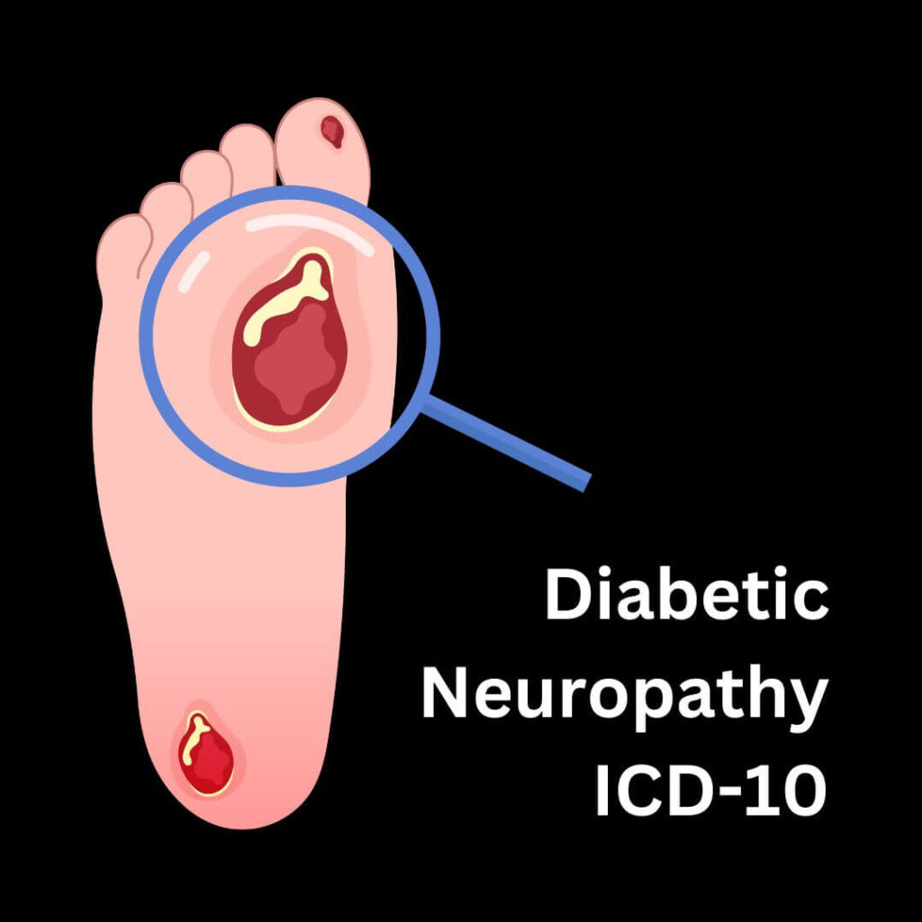 Diabetic Neuropathy icd-10