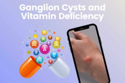 Ganglion Cyst and Vitamin Deficiency: Causes and Treatment