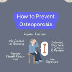 How to prevent osteoporosis infographic