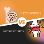 Osteoporosis and arthritis